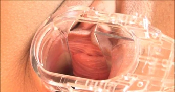 Arianna'nın spekulumu