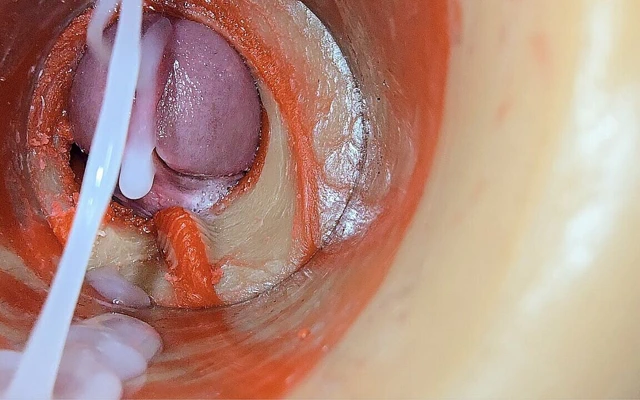 Kadın dölleme - iç kamera derin erkek büyük boşalmasını yakalıyor