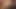 Amnesiac lezbiyen kadın anılarını istiyor