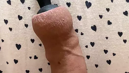 Sünnete aşırı hava şişirmek porno