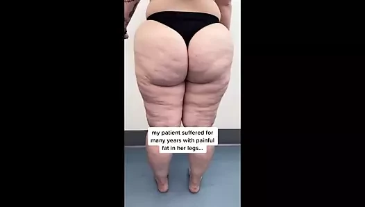 Geniş kalçalar ve büyük sulu eşekler - bir derleme bölüm 1